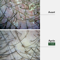 Gommage Actif Anti-Pelliculaire