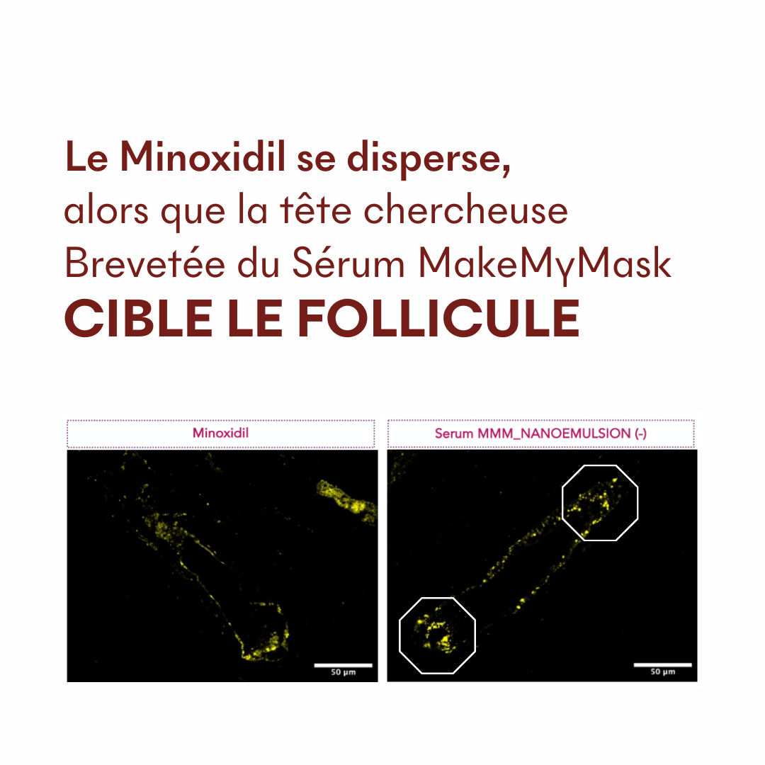 Sérum Anti-Chute Tricho-Boost