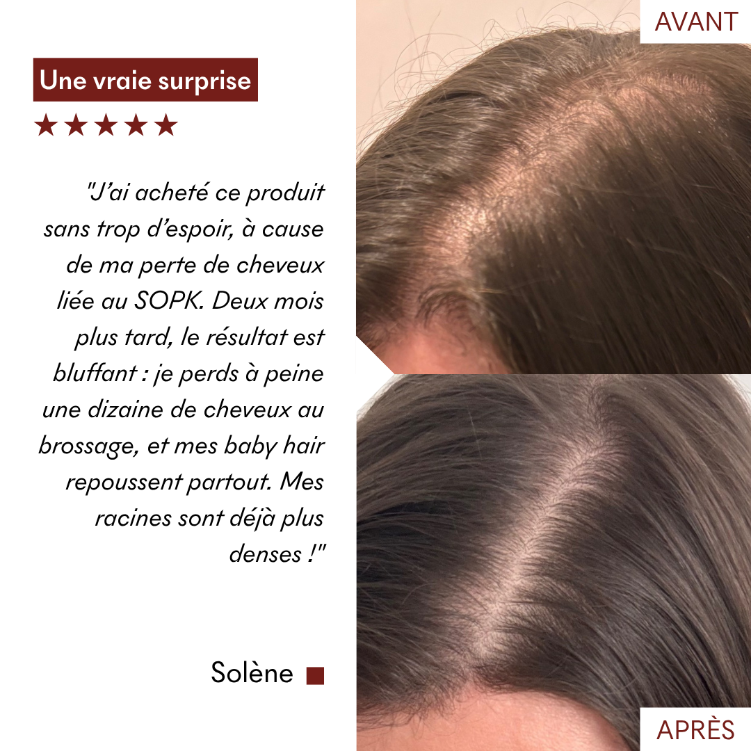 anti_chute_avant_apres_makemymask_1.png__PID:4764597a-2881-4ae1-b43e-d77f818ac71d