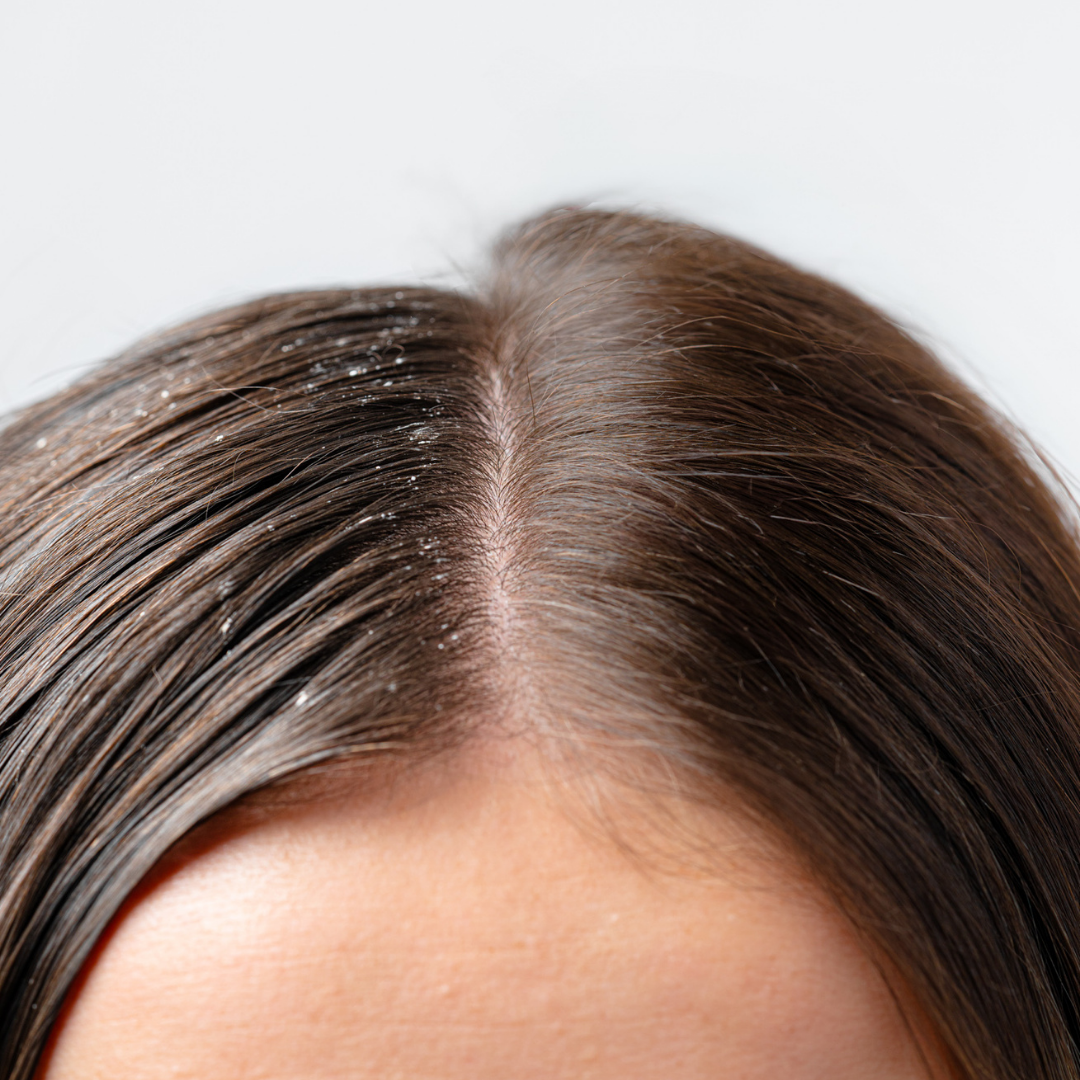 Gommage Actif Anti-Pelliculaire