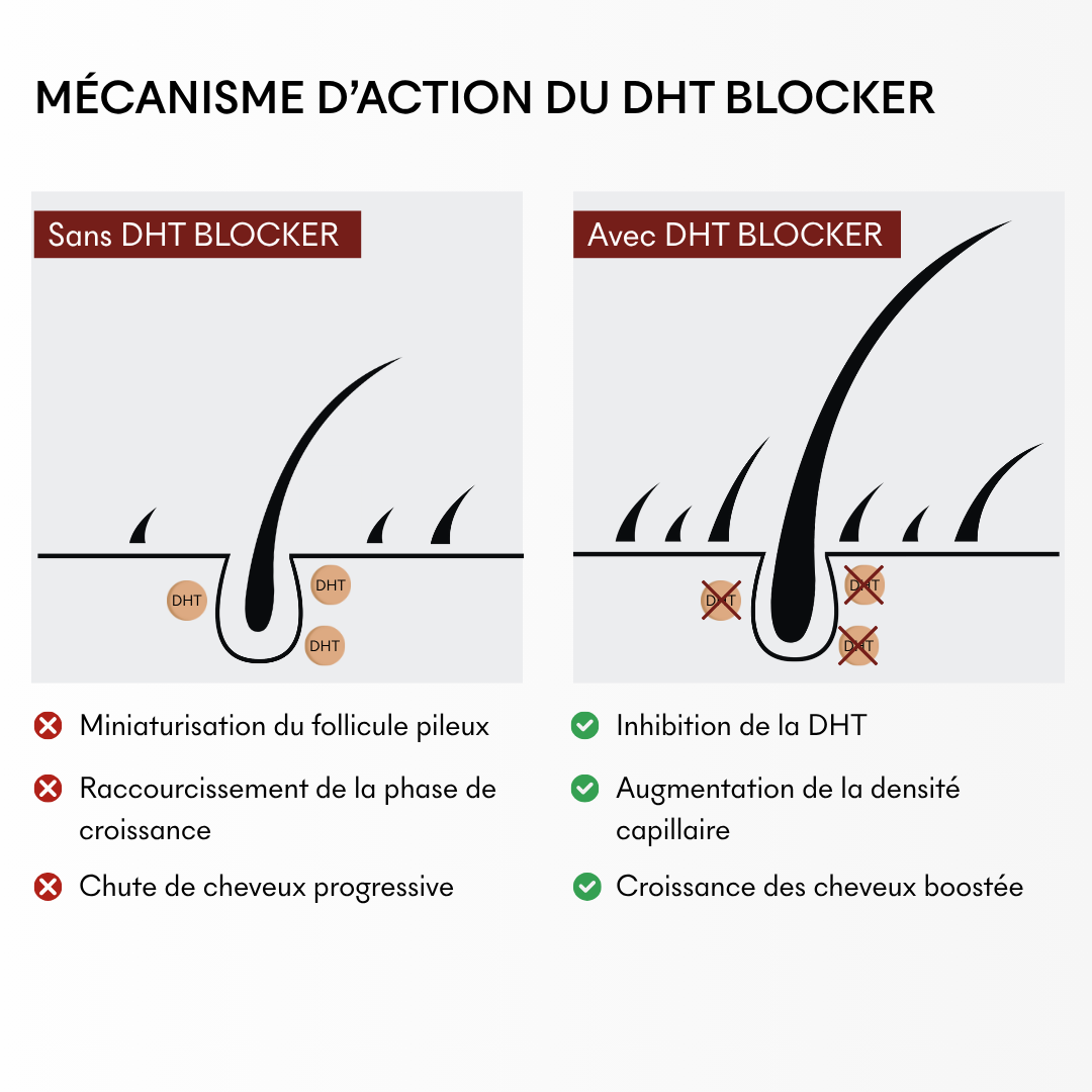 Offre 3+1 DHT Blocker Anti-Chute Hormonale 3 MOIS