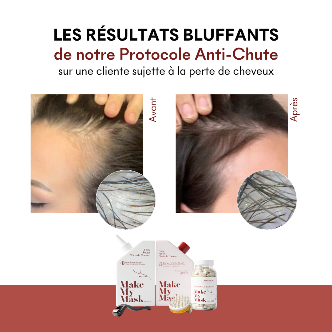 Shampoing Anti-Chute Tricho-Force pH5