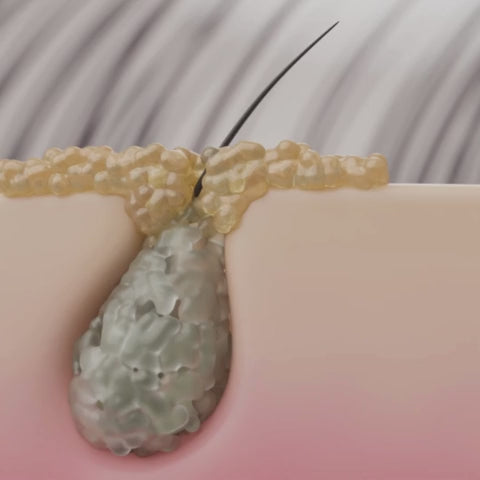 Boue Anti-Chute & Pousse