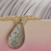 Gommage Actif Anti-Pelliculaire