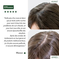 Gommage Actif Anti-Pelliculaire
