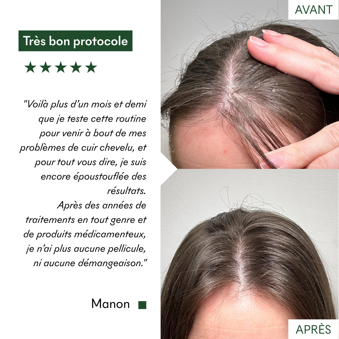 Avis