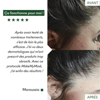 Complément SOS Plaques Sèches