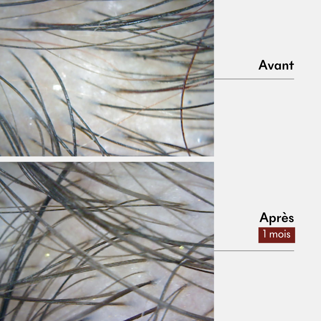 Resultat soin anti-chute et pousse